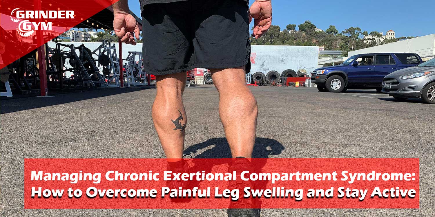 Managing Chronic Exertional Compartment Syndrome: How to Overcome Painful Leg Swelling and Stay Active